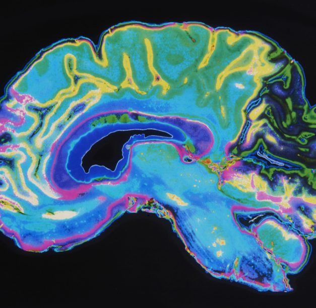 BNA Technology – Brain Mapping Solutions and What They Help Treat