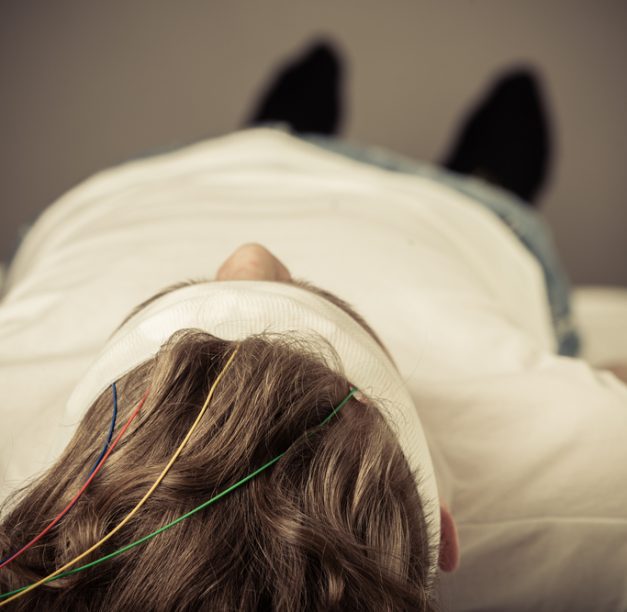 Exploring Concussion Diagnosis With Brain Network Analytic (BNA)
