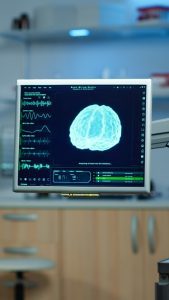 Neurofeedback for Concussions: A Path to Healing