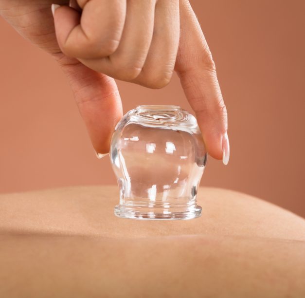 The Science Behind Cupping Therapy for Anxiety: Does It Work?