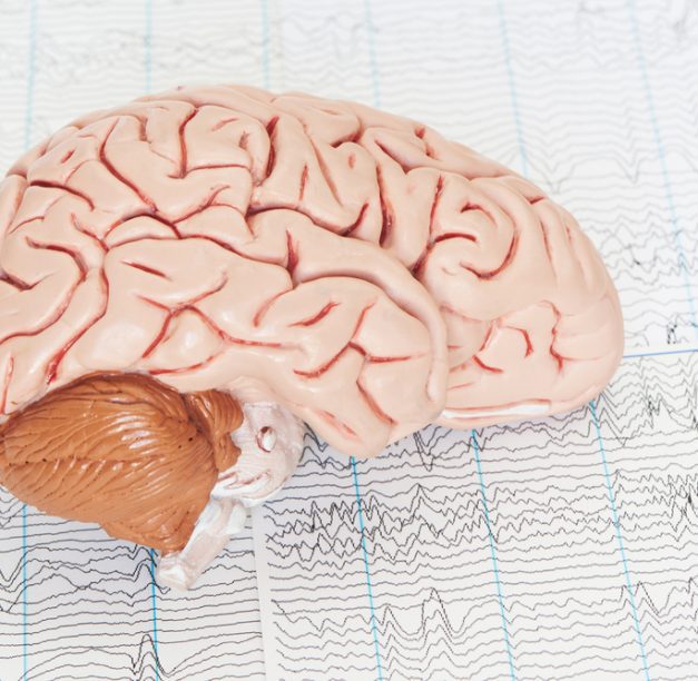 What to Expect Before and After TMS Therapy