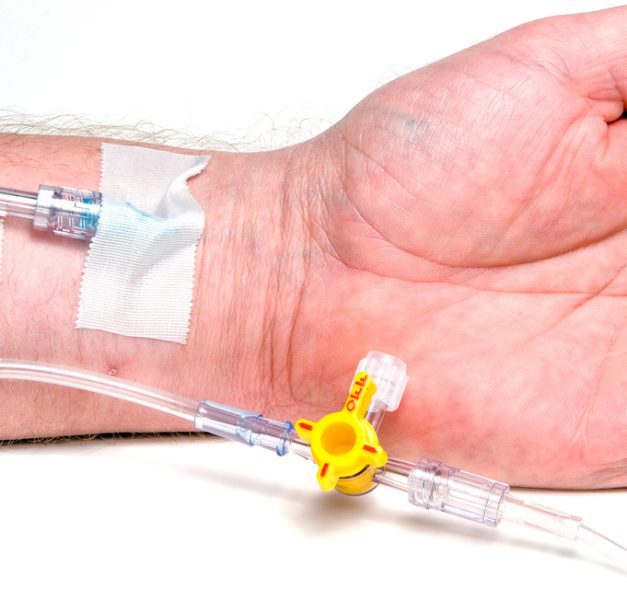 How Ketamine Therapy Is Shaping the Future of Mental Health Care
