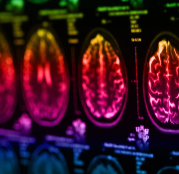 The Role of Brain Imaging in Diagnosing and Treating Mental Health Disorders