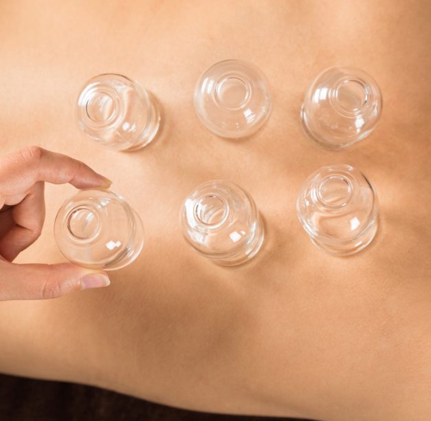 The Science Behind Cupping Therapy Health Benefits: Does It Work?