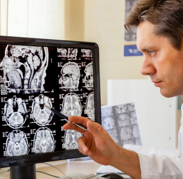 How Brain Health Consultants Can Transform Your Mental Wellness Journey