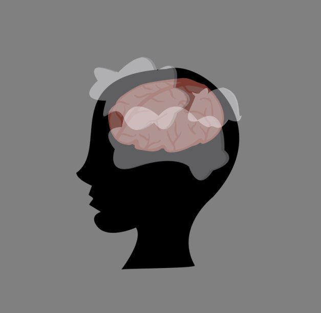 What is Brain Fog? Causes, Diagnosis, & Recovery Plan