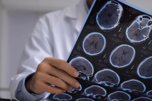 Can TMS Help with OCD Symptoms? Here’s What We Know