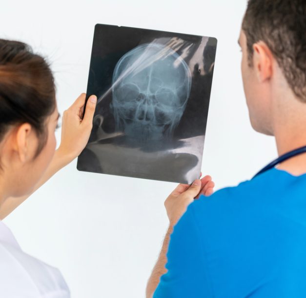 Concussion Treatment Center: Finding Specialized Care When Symptoms Won’t Go Away