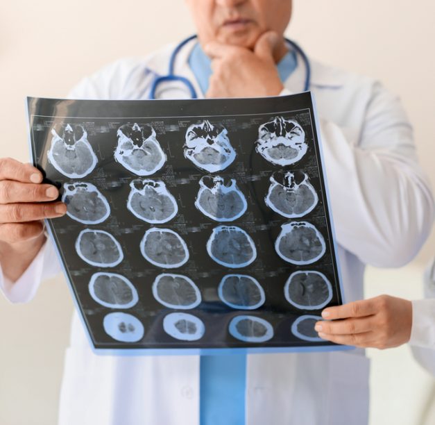 Celebrating Substance Use Awareness Month: Brain-Based Support Strategies