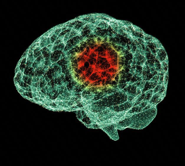 Brain Mapping Mental Health Assessment vs Traditional Mental Health Evaluations