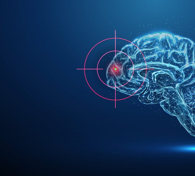 Why TMS Doesn’t Work for Everyone and What to Try If It Doesn’t Help You