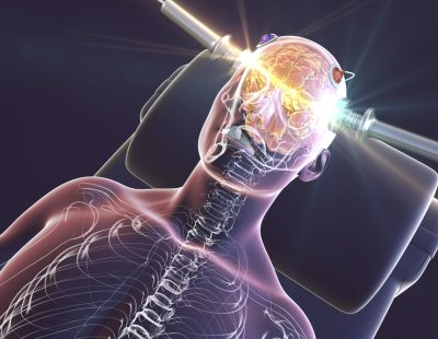 TMS vs. ECT: What’s the Difference and Which Is Safer?