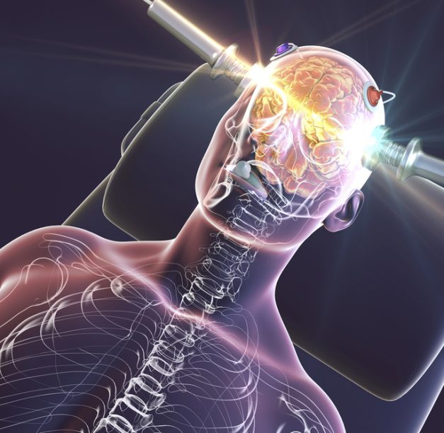 TMS vs. ECT: What’s the Difference and Which Is Safer?